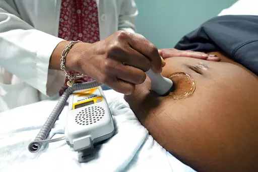 A doctor uses a hand-held Doppler probe on a pregnant woman to measure the heartbeat of the fetus on Dec. 17, 2021, in Jackson, Miss. As the first bills trickle in for Louisiana's upcoming legislative session, among them is proposed legislation that would allow mothers to “recover” 50% of out-of-pocket pregnancy-related medical expenses from the father of their child. (AP Photo/Rogelio V. Solis, File)