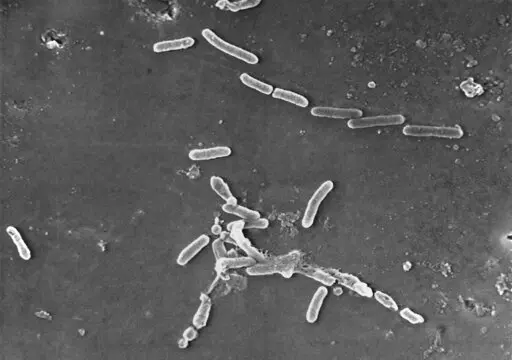 This scanning electron microscope image made available by the Centers for Disease Control and Prevention shows rod-shaped Pseudomonas aeruginosa bacteria. U.S. health officials are advising people to stop using the over-the-counter eye drops, EzriCare Artificial Tears, that have been linked to an outbreak of drug-resistant infections of Pseudomonas aeruginosa. The Centers for Disease Control and Prevention on Wednesday night, Feb. 1, 2023, sent a health alert to physicians, saying the outbreak i