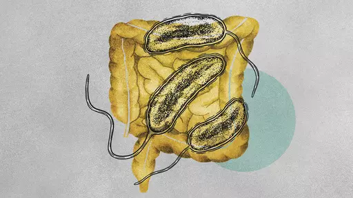 Illustration about the rise of Cholera cases. (Illustration/Amelia Bates, Grist via AP)