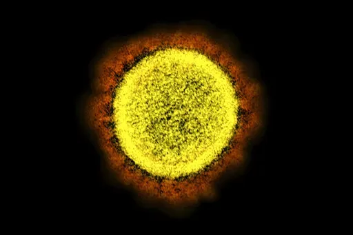 This 2020 electron microscope image made available by the National Institute of Allergy and Infectious Diseases shows a Novel Coronavirus SARS-CoV-2 particle isolated from a patient, in a laboratory in Fort Detrick, Md. The coronavirus mutant widely known as stealth omicron is now causing more than a third of new omicron cases around the world. But scientists still don’t know how it could affect the future of the pandemic. (NIAID/NIH via AP, File)