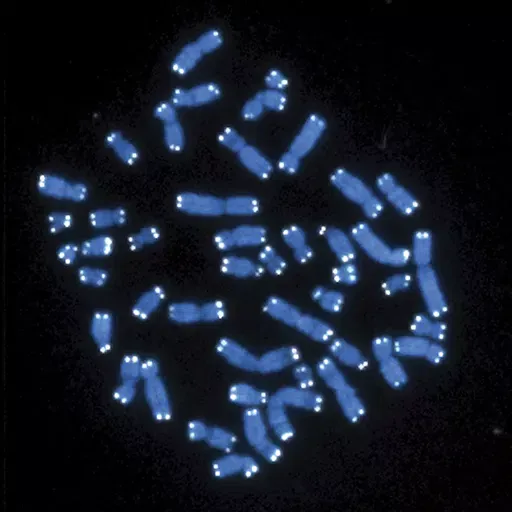 This microscope image shows the 46 human chromosomes, blue, with telomeres appearing as white pinpoints. Scientists have found the genetic cause of a neurodevelopmental disorder that they estimate affects as many as one in 20,000 young people. And they hope their discovery leads to a new diagnosis that can provide answers to families. They published their findings in the journal Nature Medicine on Friday (Hesed Padilla-Nash, Thomas Ried/National Cancer Institute/National Institutes of Health via