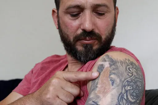 Al Noor mosque shooting survivor Temel Atacocugu points to the scar of a bullet wound in his arm during an interview at his home, Feb. 25, 2020, in Christchurch, New Zealand. Survivors from the mass shooting at two Christchurch mosques describe their reactions to the Buffalo supermarket shooting. The Buffalo gunman was apparently inspired by the Christchurch shooter after watching a copy of his livestream video. (AP Photo/Mark Baker, File)