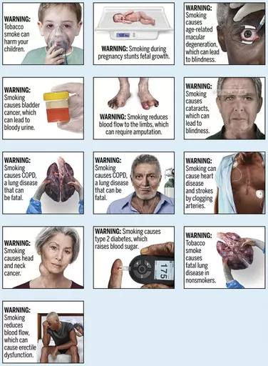 This image provided by the U.S. Food and Drug Administration, Thursday, Aug. 15, 2019, shows proposed cigarette warning labels. A federal rule requiring that cigarette packs and advertising include graphic images demonstrating the effects of smoking, including pictures of smoke-damaged lungs and feet blackened by diminished blood flow, does not violate the First Amendment, a federal appeals court ruled Thursday, March 21, 2024. (FDA via AP, File)