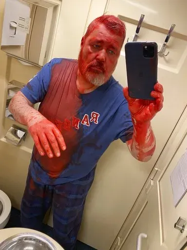 In this photo published on Novaya Gazeta Europe's Telegram channel, Nobel Peace Prize-winning newspaper editor Dmitry Muratov takes a selfie after he said he was attacked on a Russian train by an assailant who poured red paint on him, causing his eyes to burn severely, Russia, Thursday, April 7, 2022. Muratov told Novaya Gazeta Europe, a project launched by newspaper staff after the paper suspended operation last week under government pressure, that the Thursday assault happened on a train headi